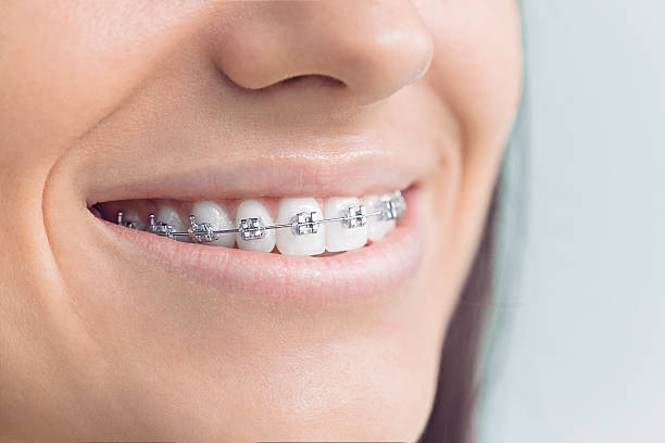 Best Veneers and Lumineers  in Tenaha, TX